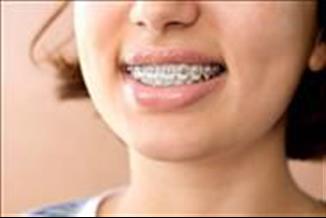 יישור שיניים לילדים -בריאות שיניים ואסתטיקה