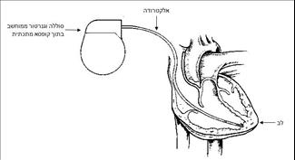 קוצב לב - המדריך המלא