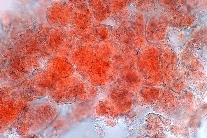 הגדלה מיקרוסקופית של רקמה המכילה תאי שומן