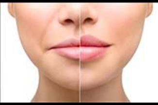 עיצוב שפתיים - החומרים, היתרונות והחסרונות שלהם