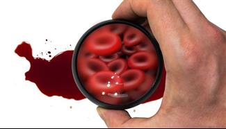 פענוח בדיקות דם - ספירת דם