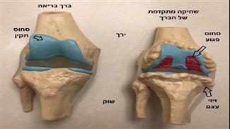 העתיד כבר כאן: החלפת ברך קינמטית