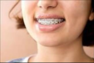 יישור שיניים לילדים -בריאות שיניים ואסתטיקה