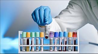 פענוח בדיקות דם - בדיקות כימיה