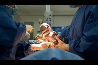 לגזור ולשמור: מהם התנאים להגשת תביעת רשלנות בלידה והריון?