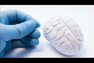 פרקינסון: מהם הטיפולים שיעצרו את הרעידות?