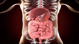 גידולי מערכת העיכול: מהם הטיפולים שישפרו את סיכויי ההחלמה?