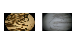 מהן בעיות השיער הנפוצות וכיצד ניתן לאבחן?