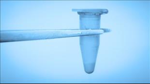 הקפאת ביציות (שימור פוריות): מתי מתבצעת ומה חשוב לדעת לפני?