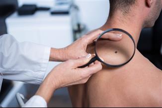 הכירו את העמותה הישראלית לסרטן העור