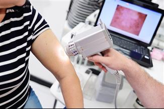 כיצד מוטציות בגנים גורמות למחלה ממאירה וגרורתית ומהי המשמעות של מוטציית בירף (BRAF) במלנומה?