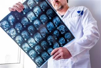 מטרשת נפוצה ועד למיאסטניה גרביס: הכירו את קבוצת המחלות הנוירו–אימונולוגיות