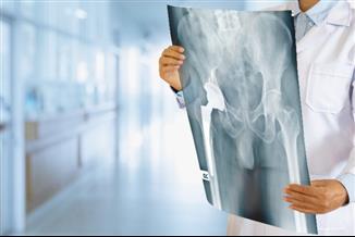 החלפת ירך: הצעדים העשויים לקצר את הליך השיקום לאחר הניתוח