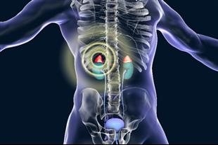 ממצאים אקראיים בבלוטת יותרת הכליה: על סוגי הגידולים, דרכי הגילוי ותהליך האבחון