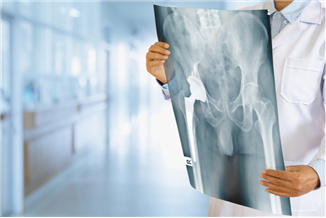 אתם שואלים – הרופא עונה: מה חשוב לדעת לקראת ניתוח החלפת מפרק ירך?