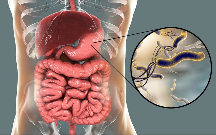 הדמייה של הליקובקטר פילורי במעיים