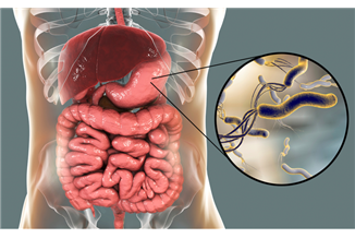 הליקובקטר פילורי : טיפול טבעי, ללא אנטיביוטיקה