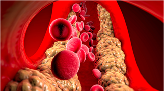 5 גורמים מפתיעים לרמות שומן גבוהות בדם