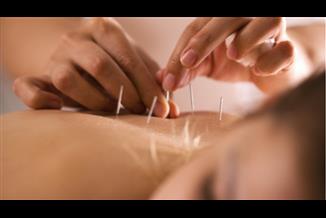 דיקור לדיכאון: האם זה עובד?