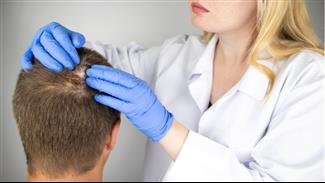 תיקון של השתלת שיער: האם זה אפשרי?