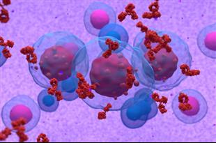 דרכי טיפול חדשניות במיאלומה נפוצה