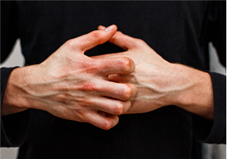 פצעים בקרקפת: המדריך המקיף לזיהוי וטיפול