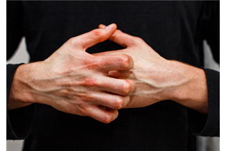 איך להרגיע אלרגיה בעור? מדריך לטיפול מהיר ויעיל