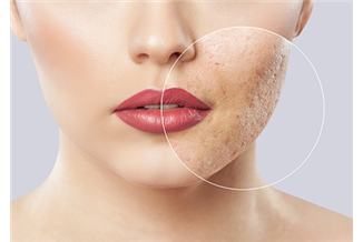 פצעים בקרקפת: המדריך המקיף לזיהוי וטיפול