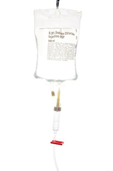 אינפוזיה של סודיום כלוריד