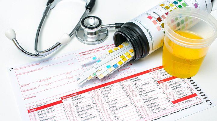 בדיקת שתן ותפקודי כליה